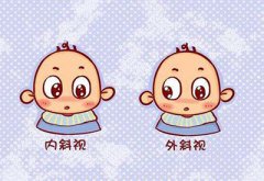 儿童综合素质测试仪厂家介绍儿童为什么会出现斜视的症状